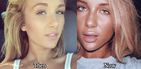 niykee heaton boobs|Niykee Heaton Surgery